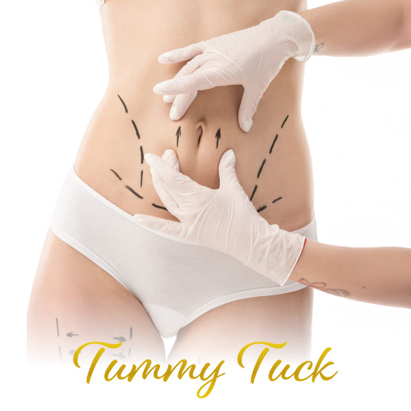 tummy tuck